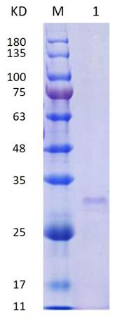 12% SDS-PAGE analysis profiles of purified MCR_RS07195-26-174 (CBB stained).